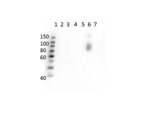 Hemoglobin beta S antibody 25 μl
