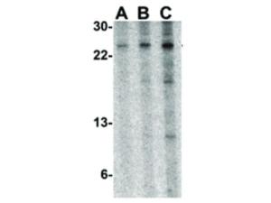 TSLP (rabbit) antibody 100 µg