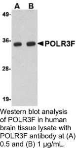 Anti-POLR3F Rabbit Polyclonal Antibody