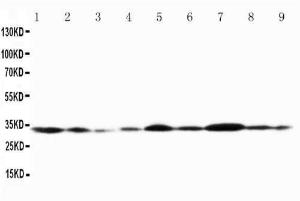 Anti-Connexin 32/GJB1 Rabbit Polyclonal Antibody