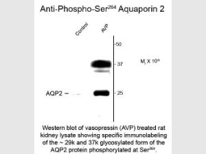 Aquaporin 2 phospho S264 antiB