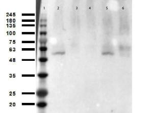 P53 K305AC antibody 25 μl