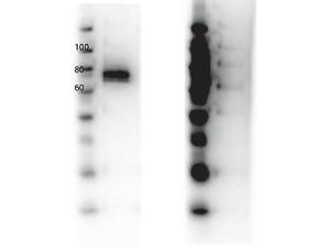 Anti-RON antibody 25 μl