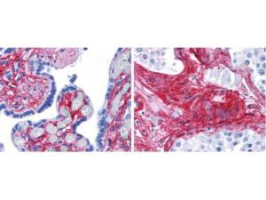 Collagen TYPE VI antibody FITC CONJ 50 μg
