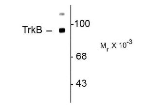 TRK B antibody 100 µl