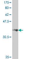 Anti-FBN1 Mouse Polyclonal Antibody