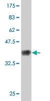 Anti-FBN1 Mouse Monoclonal Antibody [clone: 3H6]