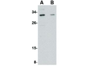 Anti-GRTP1 (Rabbit) antibody 100 μg