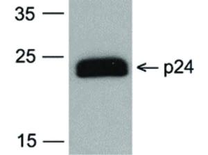 HIV-1 P24 antibody [7F4]-Biotin 100 μg