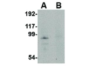 JPH-4 antibody 100 μg