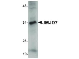 JMJD7 antibody 100 μg