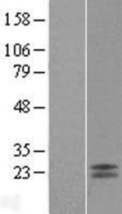 ANGPTL2 Overexpression Lysate (Adult Normal), Novus Biologicals (NBL1-07525)