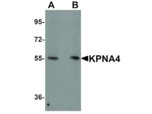 KPNA4 antibody 100 μg