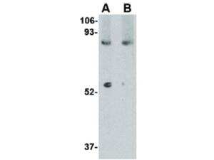 LGI1 (RB) antibody 100 μg