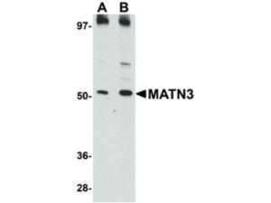 Anti-MATN3 (Rabbit) antibody 100 μg