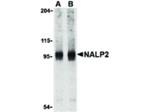 NALP2 antibody 100 μg