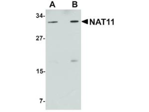 NAT11 antibody 100 μg