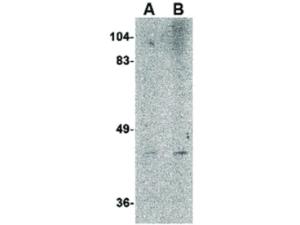 NIPSNAP2 (Rabbit) antibody 100 μg