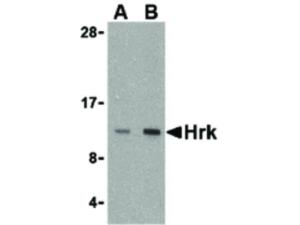 HRK antibody 100 µg