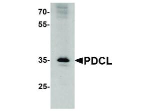 PDCL antibody 100 μg
