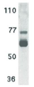 IL-22 (rabbit) receptor antibody 100 µg