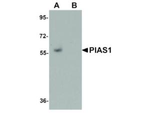PIAS1 antibody 100 μg