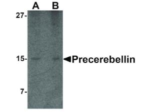 Precerbellin antibody 100 μg