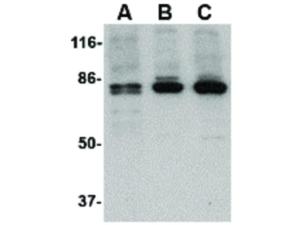 PTK7 (Rabbit) antibody 100 μg