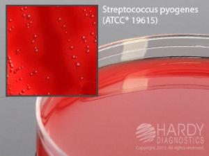 GBS Detect/Strep Reagents, Hardy Diagnostics