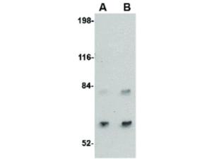 SAMHD1 antibody 100 μg