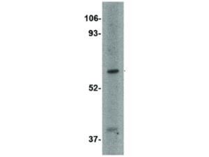 LGI1 (rabbit) antibody 100 µg