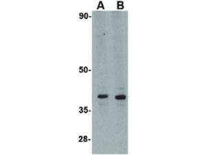 LGP2 (RB) antibody 100 µg