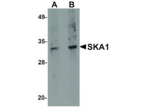 SKA1 antibody 100 μg