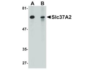 SLC37A2 antibody 100 μg