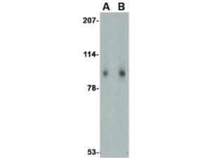SLITRK1 antibody 100 μg