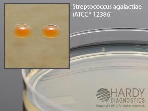 GBS Detect/Strep Reagents, Hardy Diagnostics