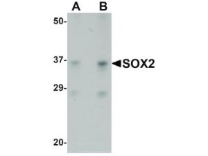 SOX2 antibody 100 μg