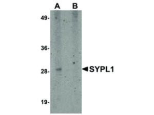 SYPL1 antibody 100 μg