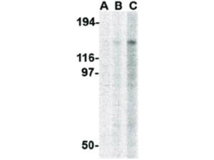 TBC1D1 antibody 100 μg