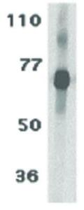 TCCR (Rabbit) antibody 100 μg