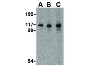 Anti-MDA5 (rabbit) antibody 100 µg