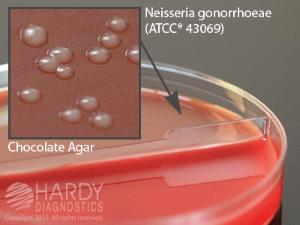 Blood Agar, 5%/Chocolate Biplate, Hardy Diagnostics