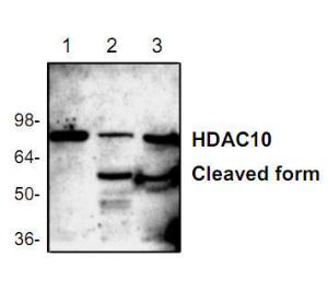 Western blot analysis ofHDAC10 expression.Lane 1: Jurkat CellsLane 2: Mouse IntestineLane 3: Rat Brain