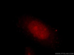 Anti-DUSP11 Rabbit Polyclonal Antibody