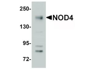 NOD4 antibody 100 µg