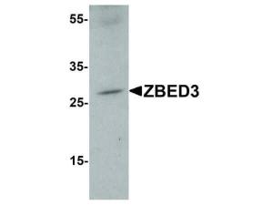 ZBED3 antibody 100 μg