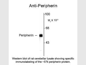 Peripherin antibody 100 µl