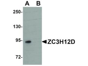 ZC3H12D antibody 100 μg