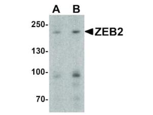 ZEB2 antibody 100 μg