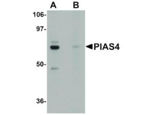 PIAS4 antibody 100 µg